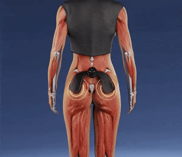 Buttock™ GluteTränaren